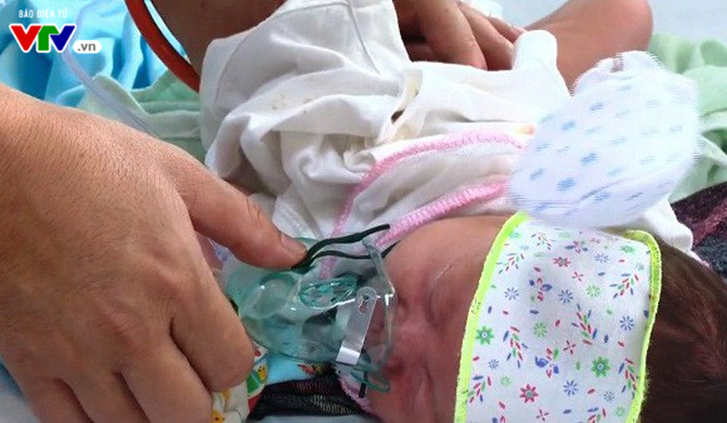 Những điều cần lưu ý khi trẻ mắc sởi