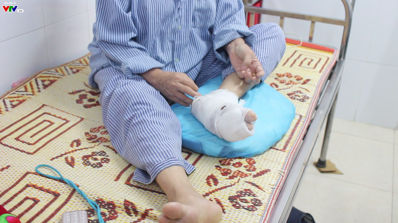 Gia tăng bệnh nhân mắc ung thư da