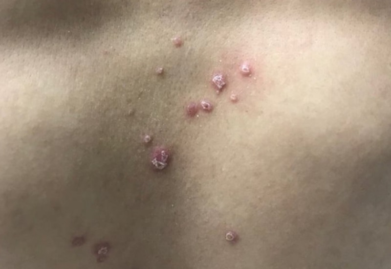TIN TỨC MỚI - Bé trai 13 tuổi mắc giang mai vì bị lạm dụng tình dục đồng giới